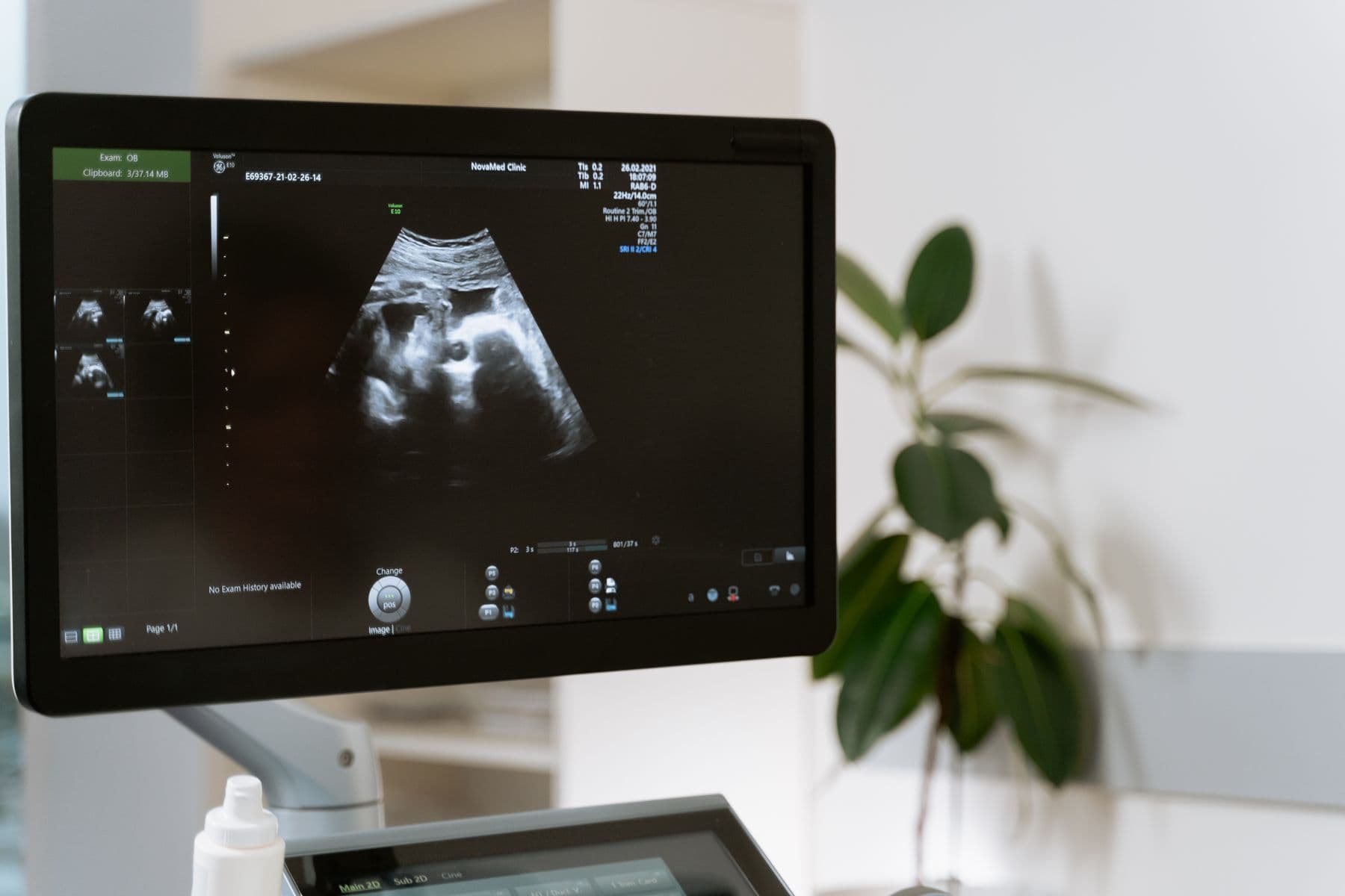 Échographe moderne en salle de consultation, écran d’imagerie obstétricale