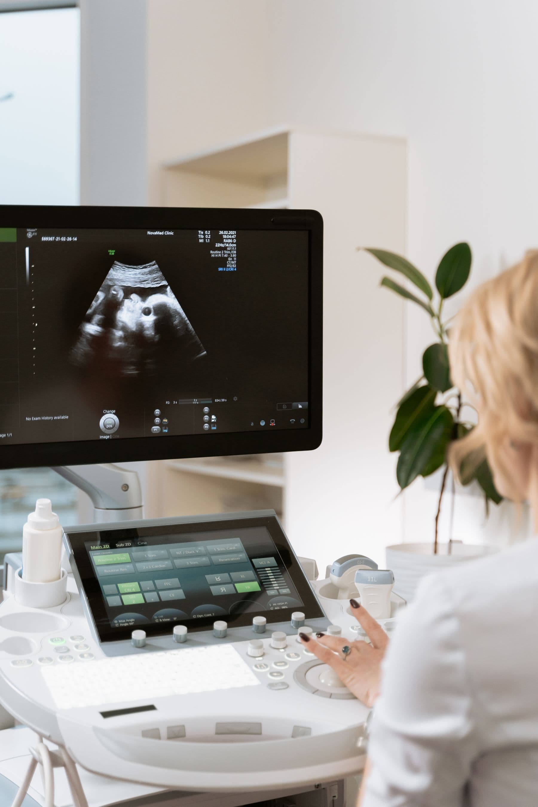 Console d’échographie obstétricale lors d’un suivi de grossesse